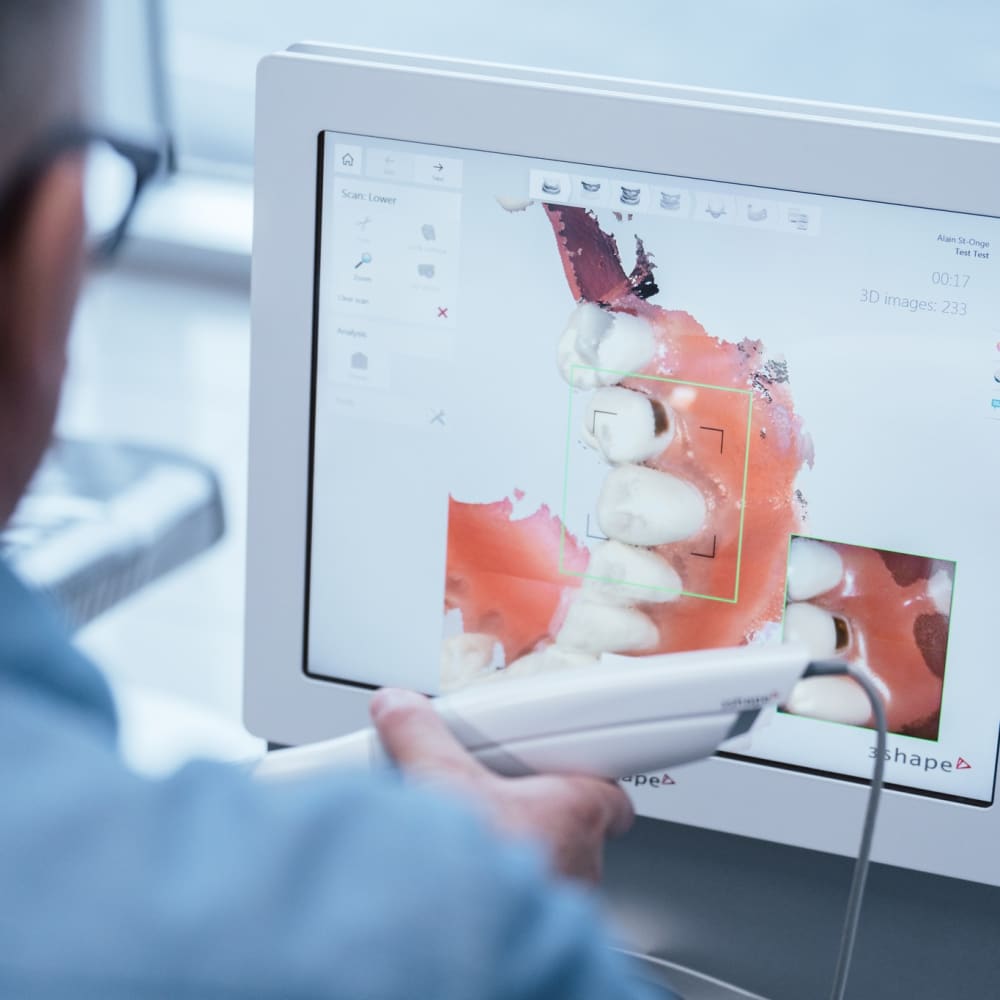 Dental Implants in La Prairie